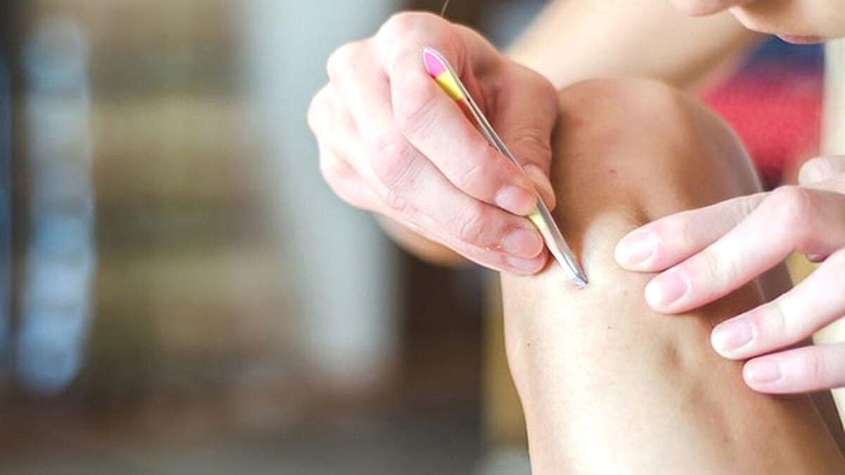 Jilet ve Peelinge Veda: Bu Tuz Batık Kılları Söküp Atıyor!