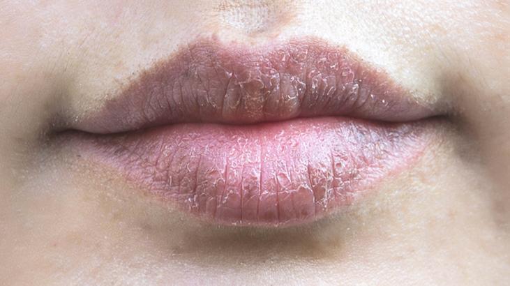 Saniyeler içinde pürüzsüz dudak görünümü! Yağların nasıl kullanılacağını öğrenin