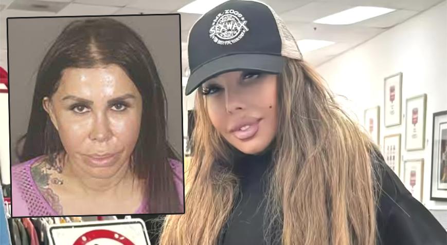 Hollywood’da estetik skandalı: Güzellik aşkı ölüm getirdi