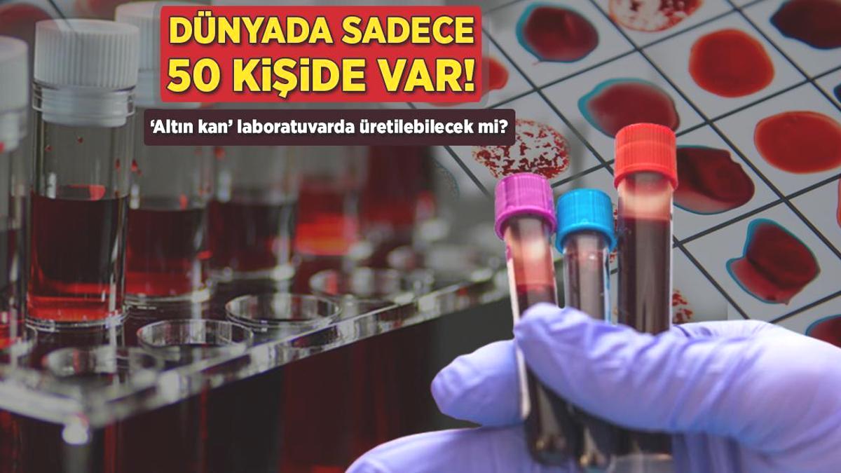 Dünyada sadece 50 kişide var! ‘Altın kan’ laboratuvarda üretilebilecek mi?