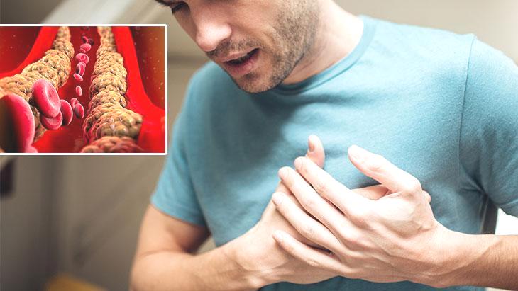 Kalbin sinsi düşmanı kötü kolesterol! Damarlarda birikiyor, kalp krizine neden olabilir