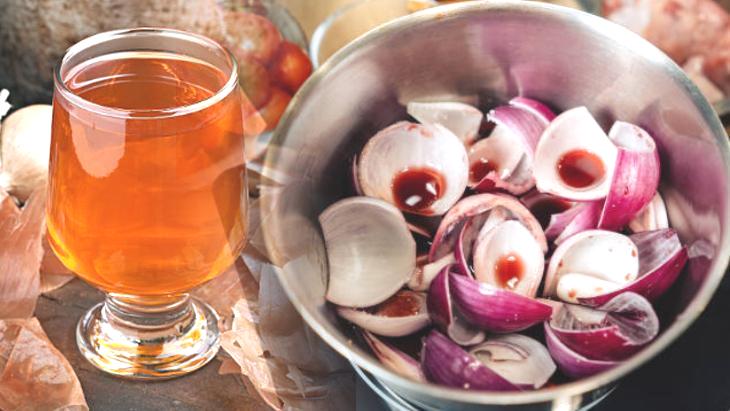 7 gün bekletip suya 3 damla atın! Böbrekteki taşı kuma çeviriyor, kepeği söküyor