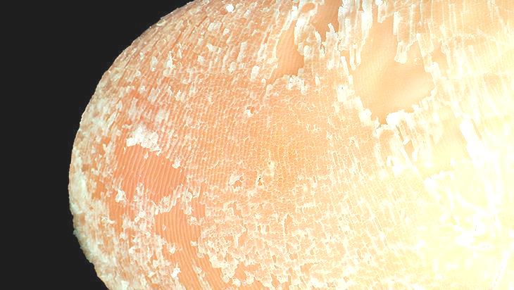 Ayaklardaki çatlaklara birebir! 3 basit ürünle pürüzsüz oluyor