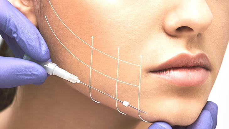 ‘Derin plan yüz germe’ tekniği kalıcılığıyla fark yaratıyor