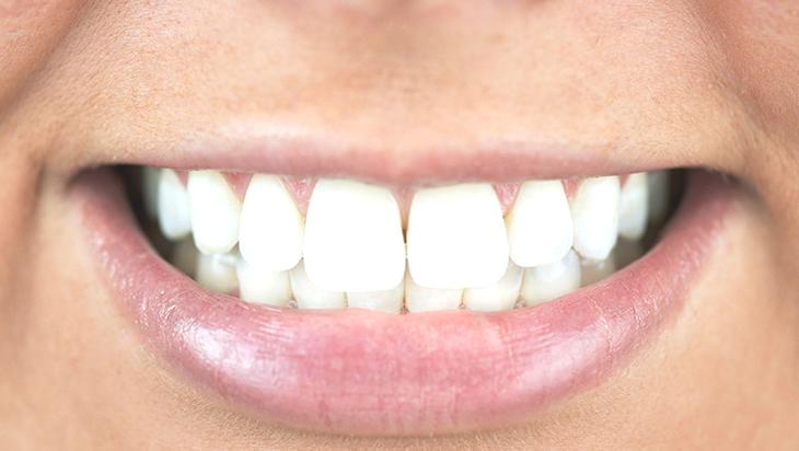 Dişleri bembeyaz yapıyor! Meğer püf noktası buymuş