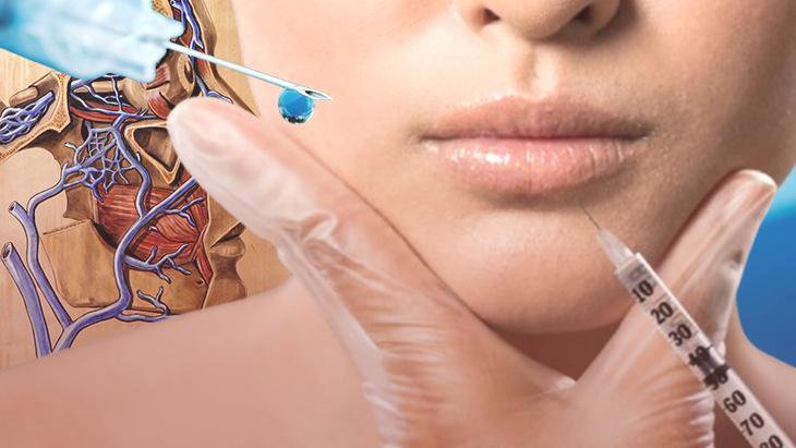 Dolgu ve botoksun karanlık yüzü! Sorun kimyasal değil iğne mi? ‘Görme kaybının dönüşü yok’