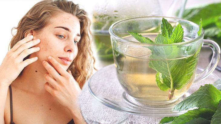 Sosyal medyada hızla yayılıyor! Kıvırcık nane çayı hormonal akneye iyi gelir mi?