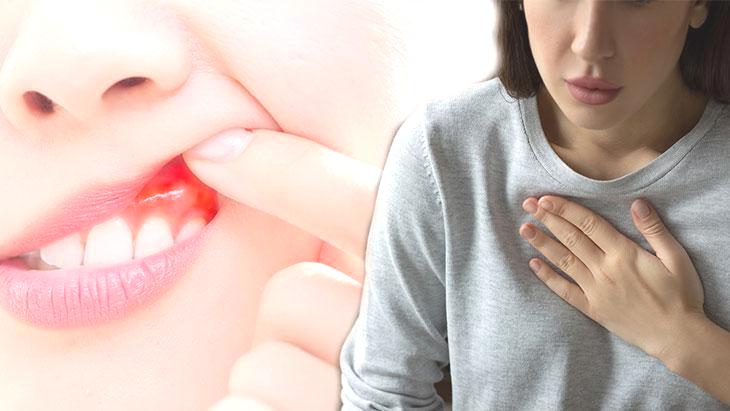 Diş eti kanaması masum değil! Kalp hastalıkları, Alzheimer ve kanserle yakından ilişkili