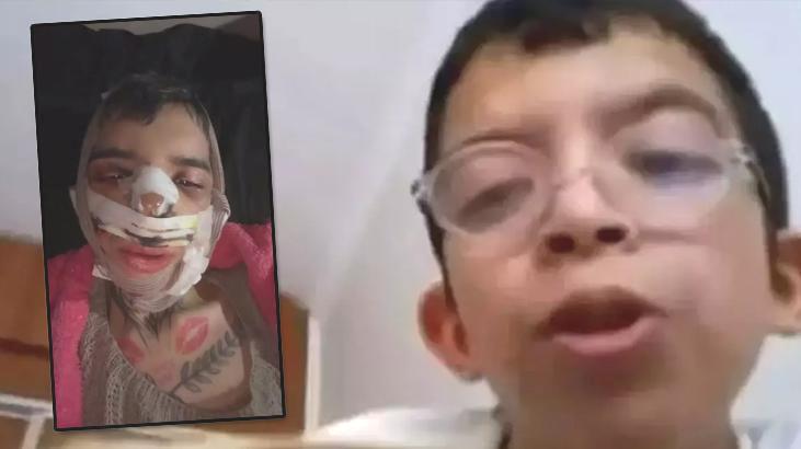 ‘Tablet Reis’ olarak tanınmıştı: Değişimi şoke etti! Eleştiriler yüzünden ameliyat masasına yattı