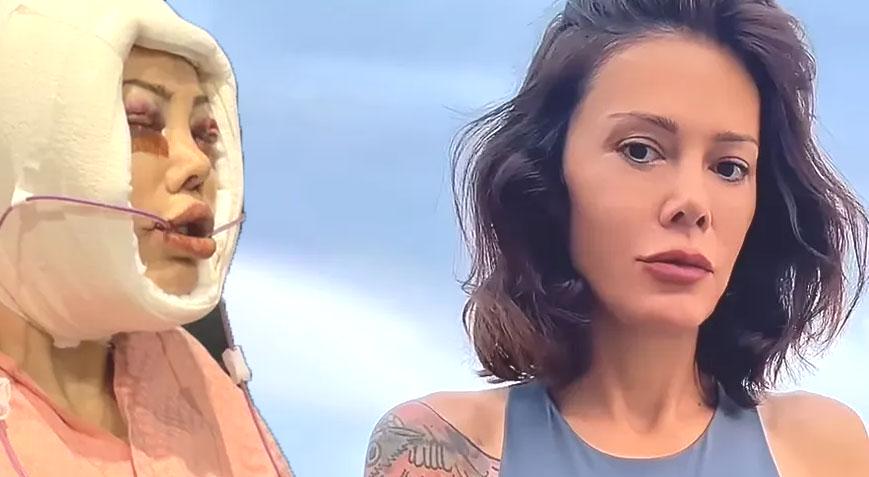 Didem Ceran yüz nakli sonrası son halini paylaştı: Bu bir estetik değil, yeniden doğuş