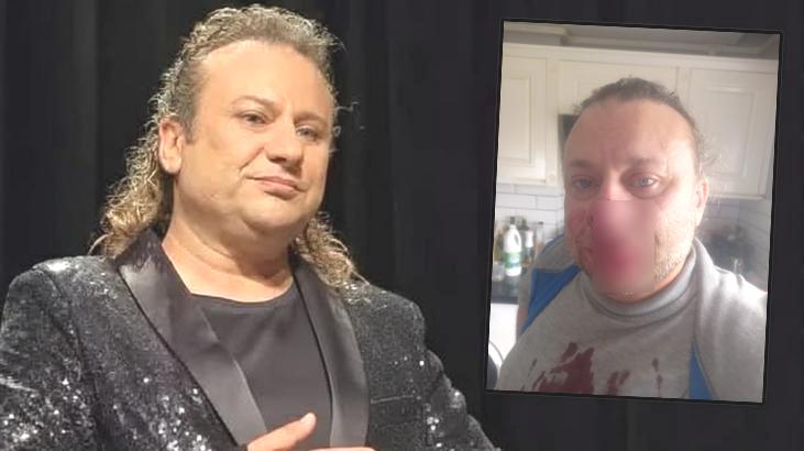 ‘Et yiyen bakteri’ ile mücadele ediyor: Onur Akay entübe edildi!