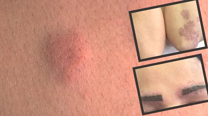 Popüler diye uyguladı kâbusu oldu! Etkisi tüm vücuduna ince ince yayıldı