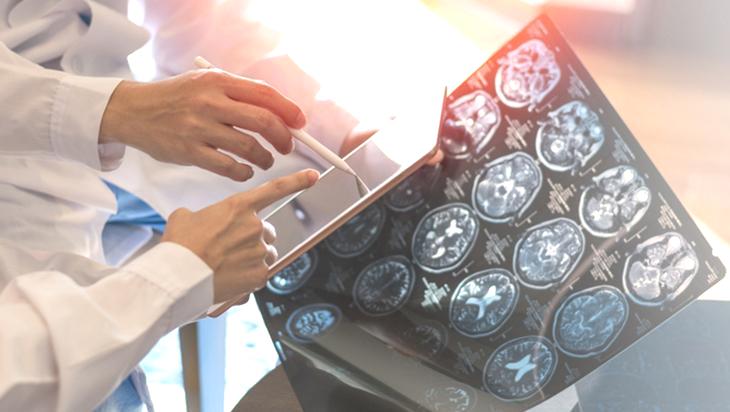 Saatlerce oturmak beyni sessizce tehdit ediyor! Demans riskinde çarpıcı artış