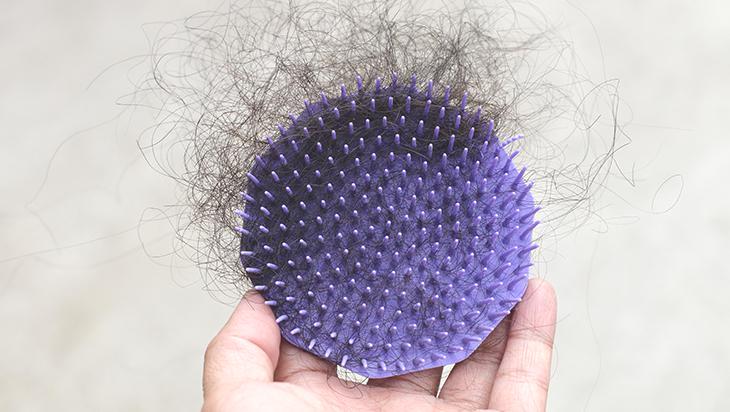 Saç dökülmesine birebir! Mutfaktaki 2 malzemeden gelen güzellik