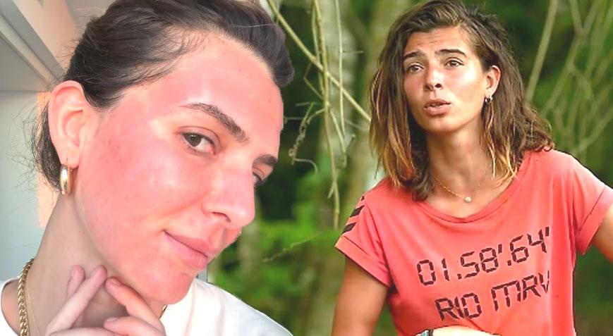 Survivor Merve Aydın’ın değişimi şaşırttı! Yüzüne yaptırdığı işlemi tek tek anlattı