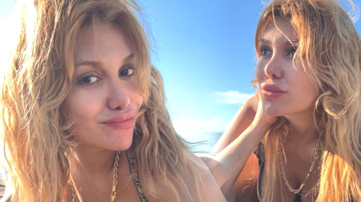 Survivor’da diskalifiye olmuştu! Almeda Baylan son haliyle görenleri şaşırttı