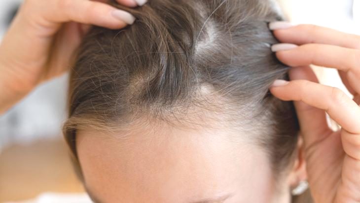 Doğal yollarla saçlarınızı canlandırın! Salon seanslarını unutturan yöntem